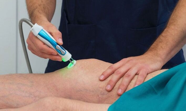 термографија на коленото зглоб со артроза